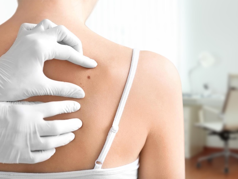 Kožní ambulance - MUDr. Zlatuše Holoubková, MUDr. Olga Dolinová