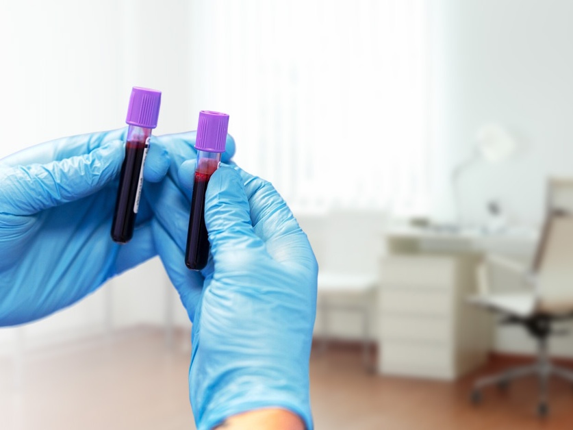 OKBH (laboratoř) - RNDr. Jiří Jelínek, Ph.D